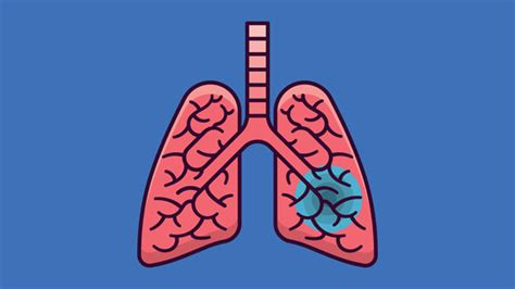 Grundlaget for lungekræft